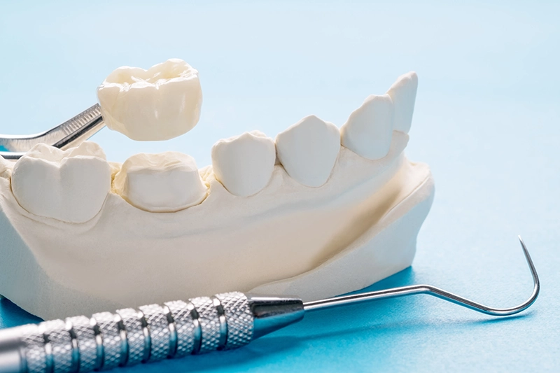 Custom dental crown at Studio One Dental