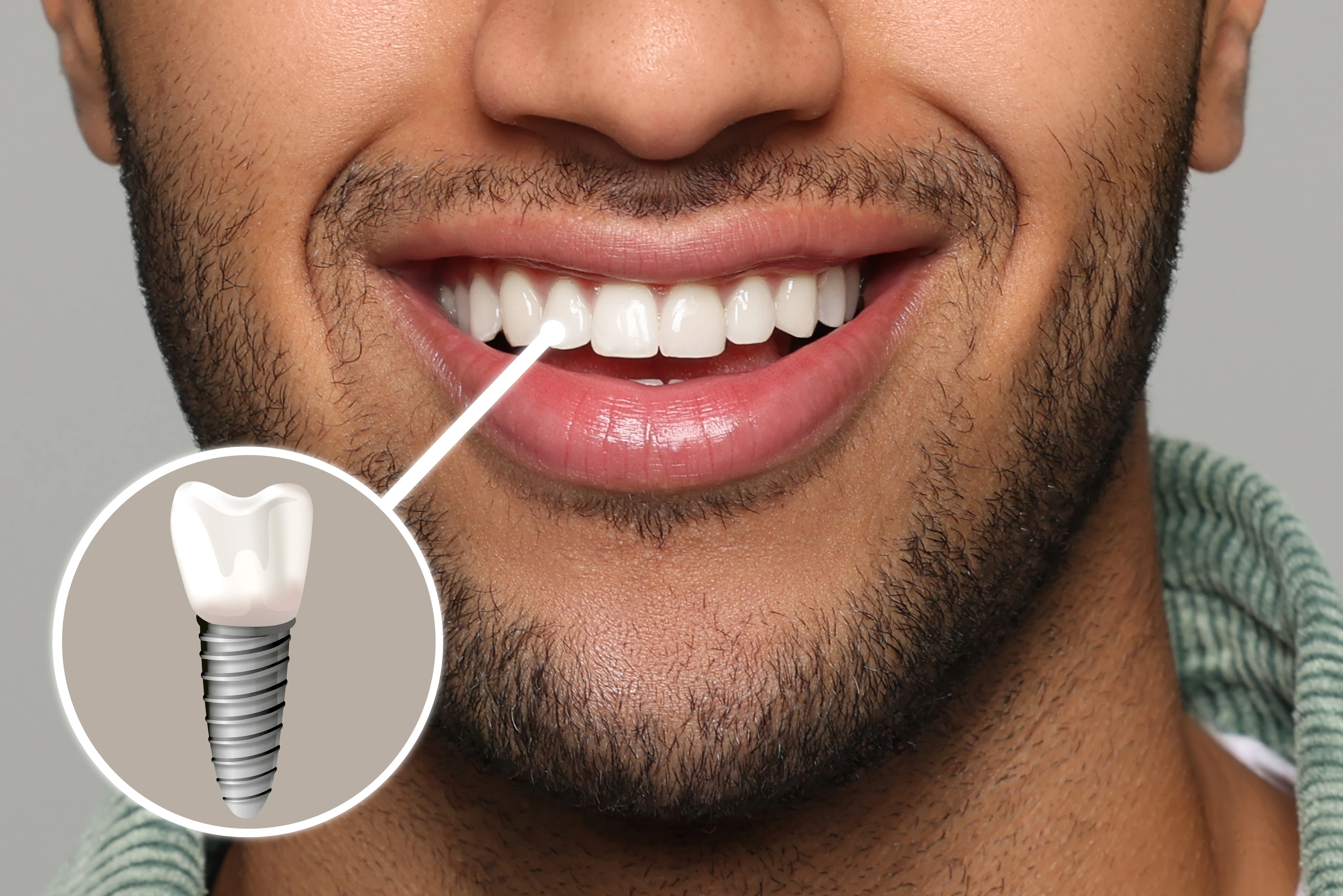 Restorative dental treatment at Studio One Dental