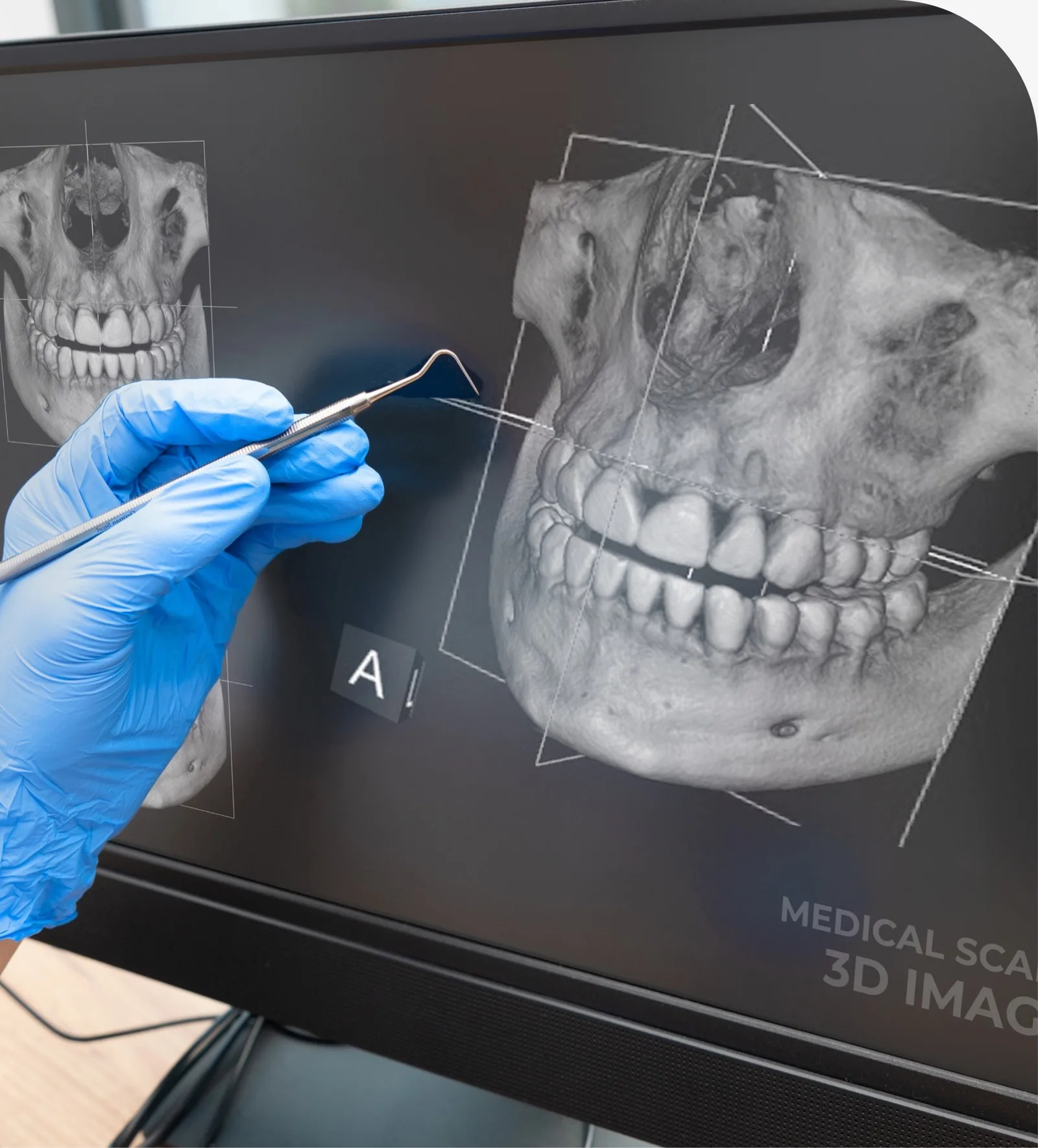 Dr. Juan Manuel Gonzalez performing endodontic treatment