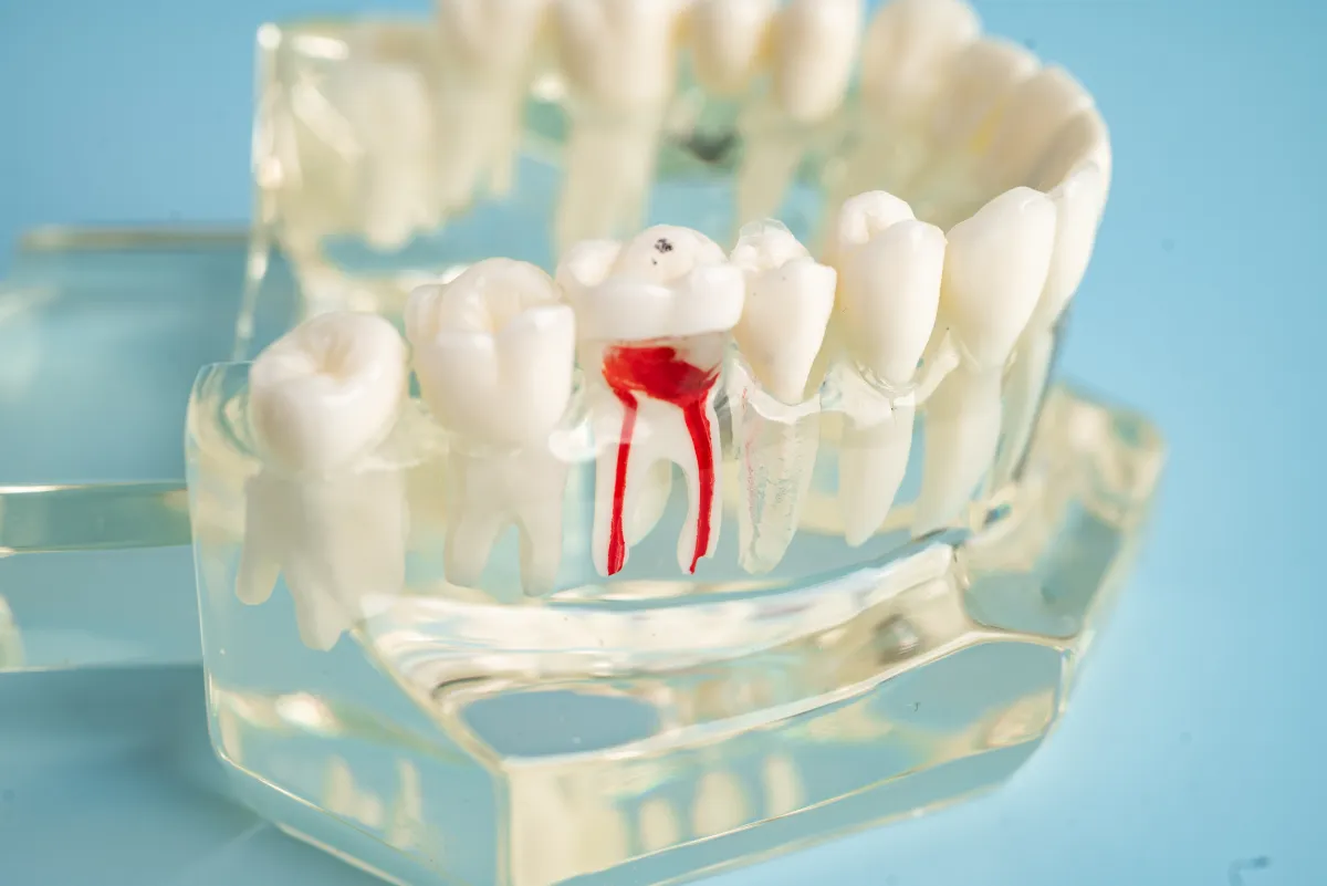 Dental model showing tooth anatomy and root canal structure